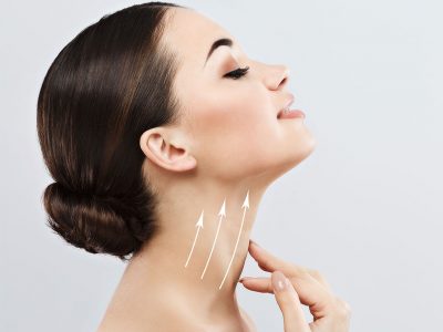 Non-Surgical Neck Plasty