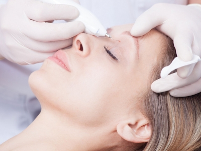 Laser application is performed on benign and non-deep moles. 