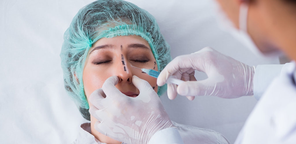 Nasal filling is used as a non-surgical nasal aesthetic application.