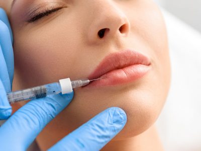 The lower and upper lips are formed by the botox process.