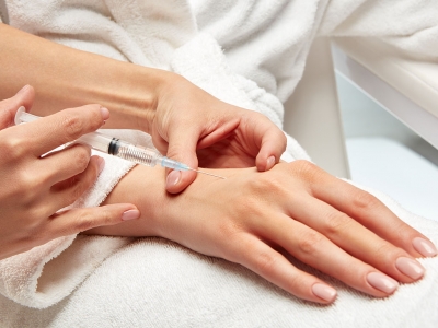 Wrinkles and spots are removed by hand rejuvenation treatment.