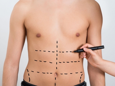 Abdominal stretching aesthetics enables the abdominal skin to recover.