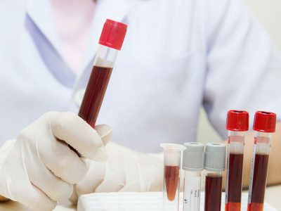 Joint pain, skin rejuvenation and hair mesotherapy are performed with stem cell therapy.