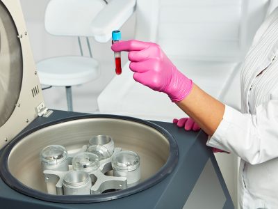 Hair prp treatment is applied for hair strengthening.