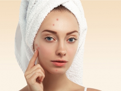 For treatment of acne scars used gold needle, mesotherapy, dermapen applications.