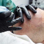 Saç Pigmentasyonu Hakkında Bilinmesi Gerekenler